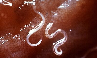 Was Parasiten in der Leber beim Menschen sind