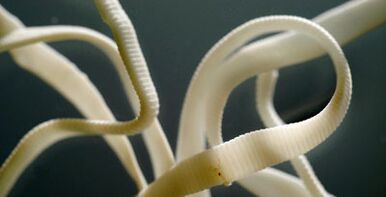 flacher Parasit aus dem menschlichen Körper