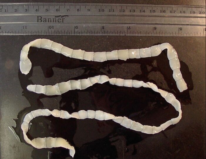 Bandwurm, der im menschlichen Dünndarm lebt